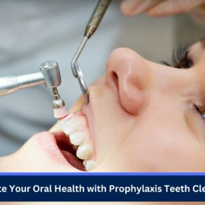 Elevate Your Oral Health with Prophylaxis Teeth Cleaning