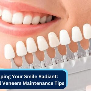 Keeping Your Smile Radiant: Dental Veneers Maintenance Tips