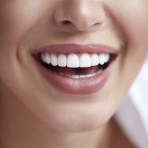 Shine with Confidence: How Teeth Whitening Can Transform Your Smile