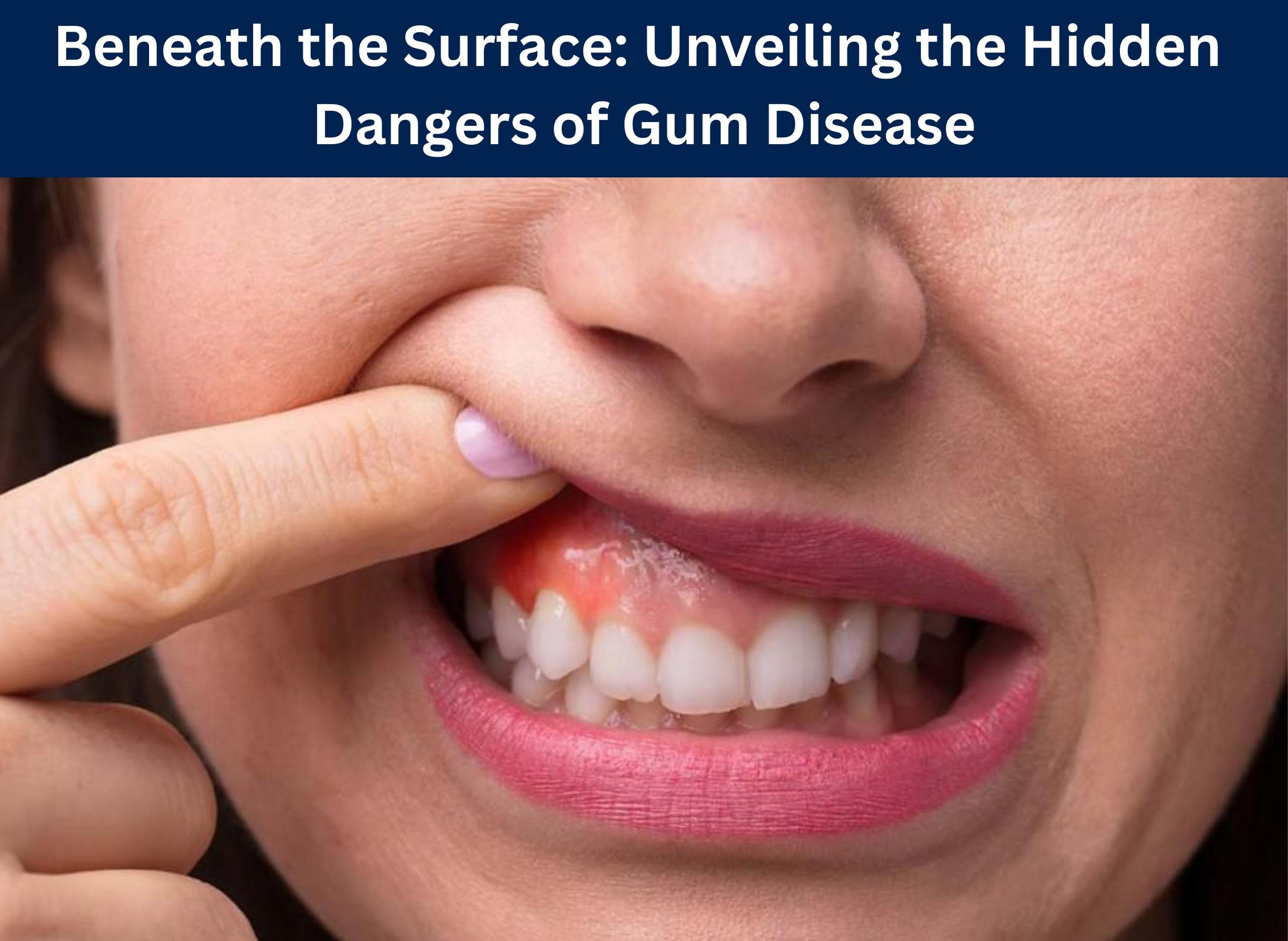 Beneath the Surface: Unveiling the Hidden Dangers of Gum Disease