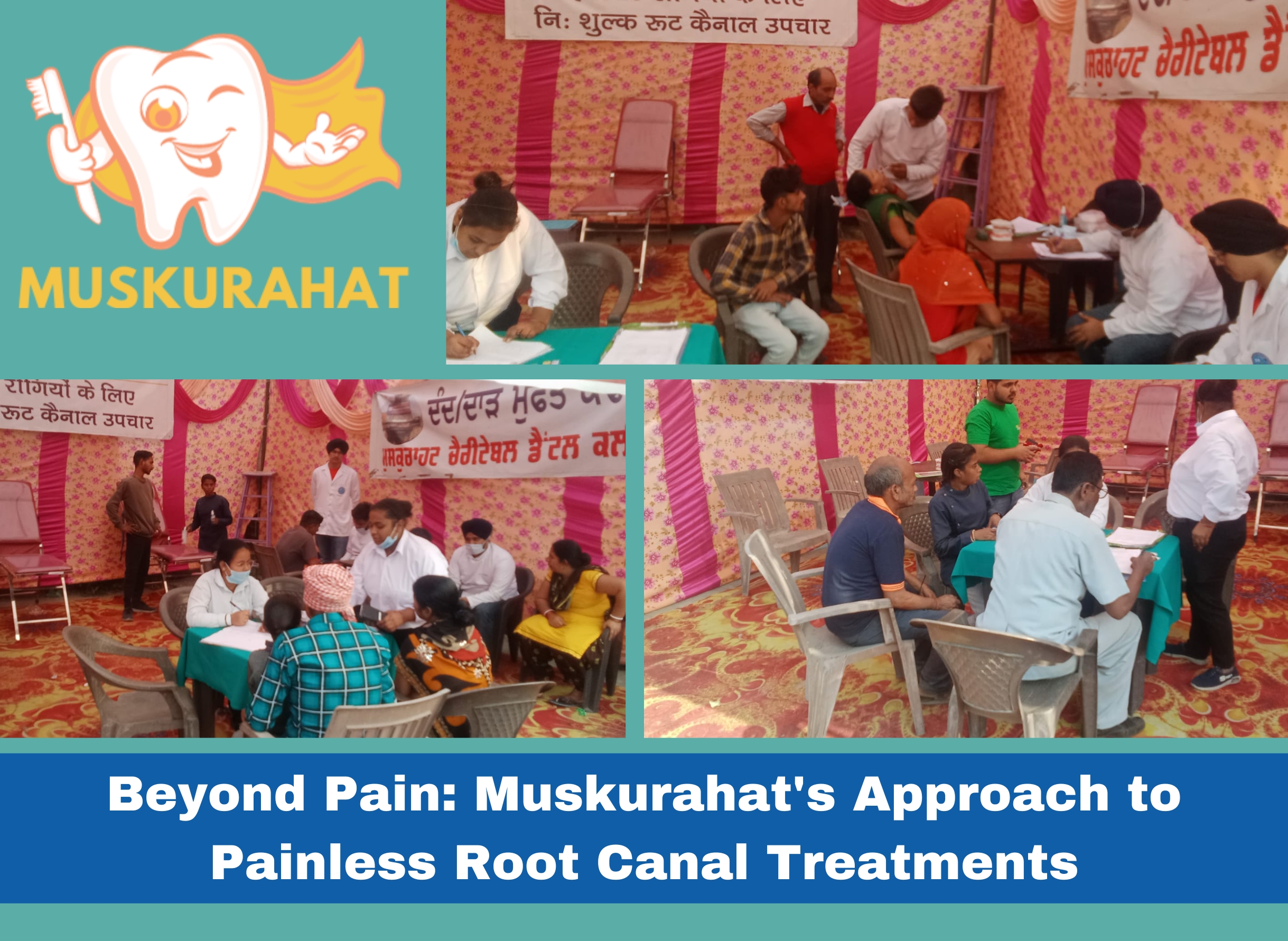 Beyond Pain: Muskurahat’s Approach to Painless Root Canal Treatments