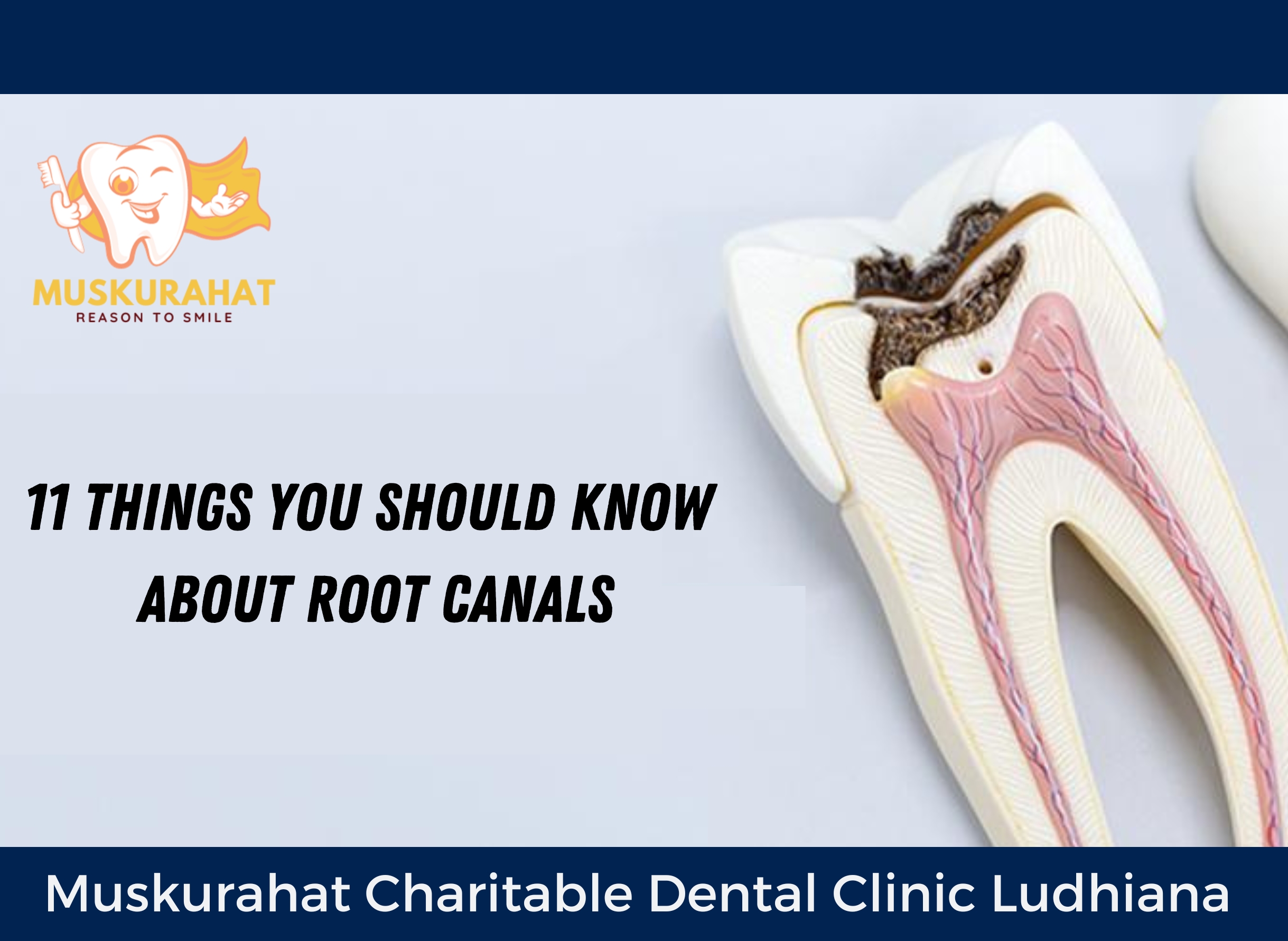 11 Things You Should Know About Root Canals