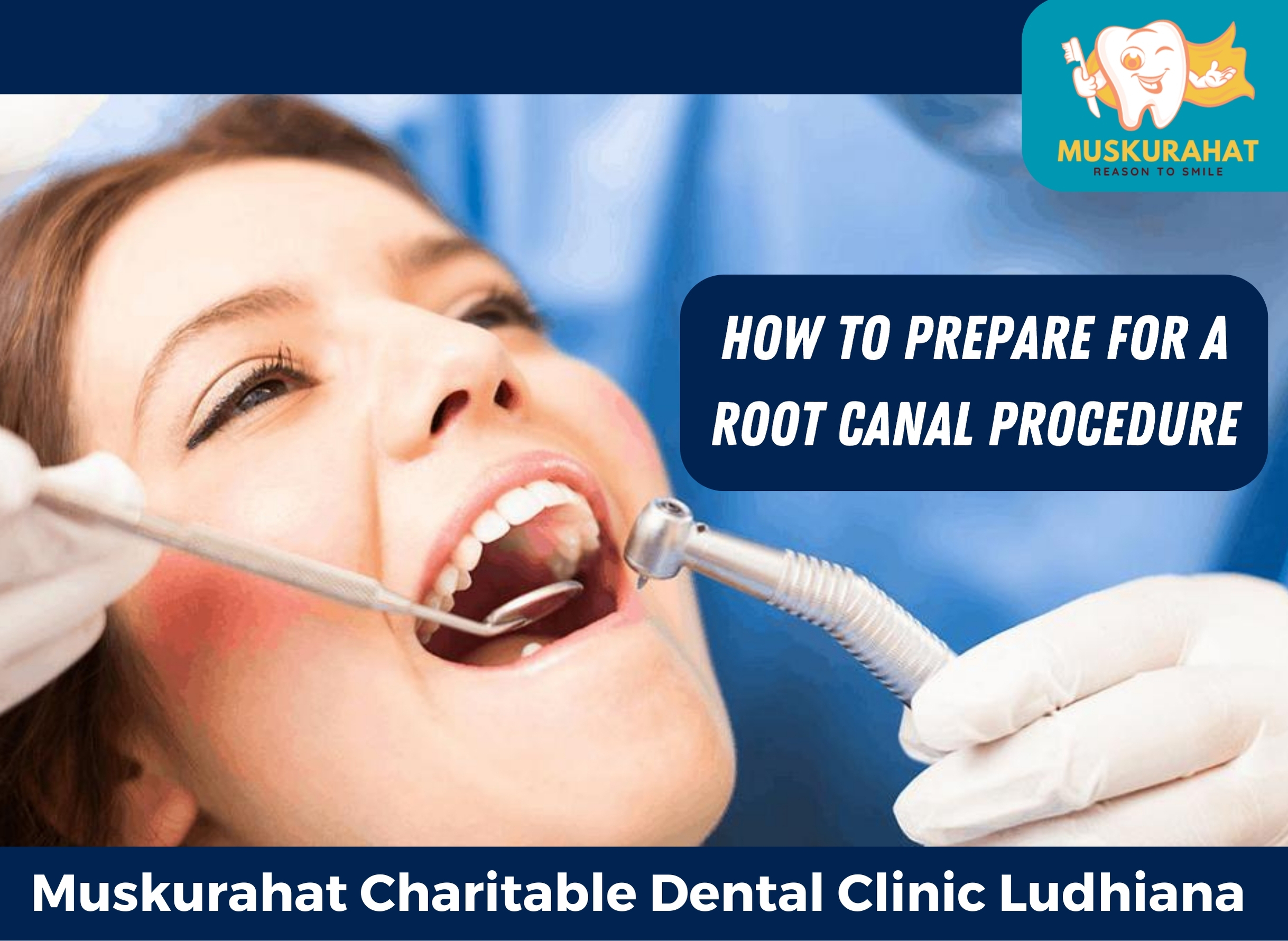 How to Prepare for a Root Canal Procedure: Tips and Advice